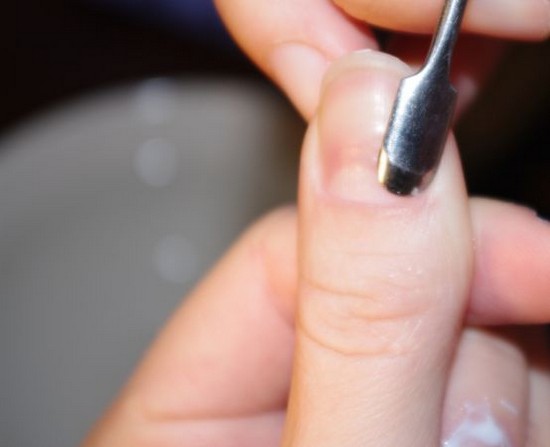 Cuticle borttagning