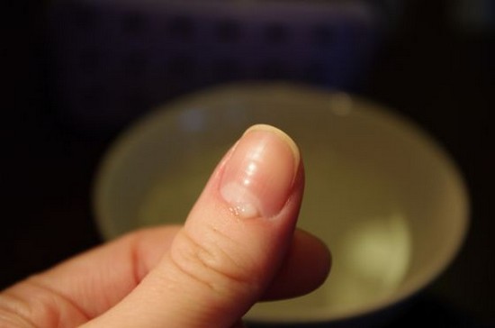 Cuticle borttagning