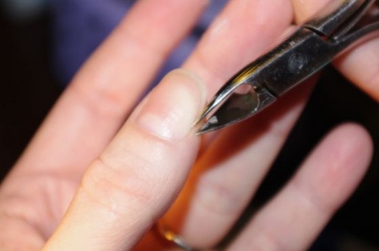 Cuticle borttagning