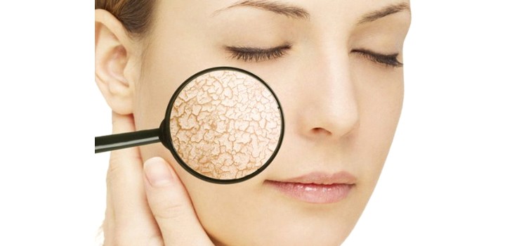 Oljor, masker och krämer för torr hud