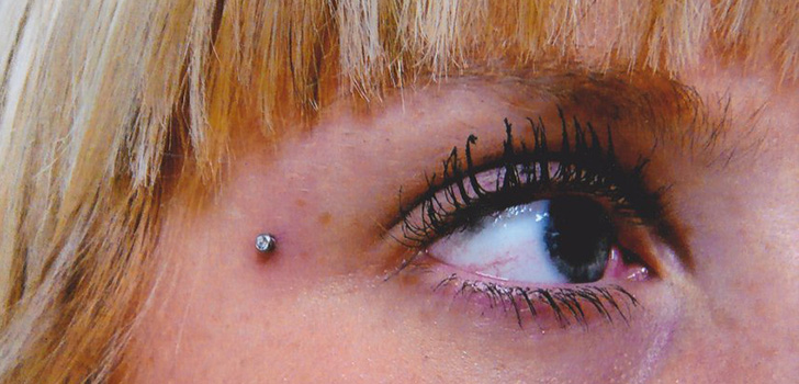 Microdermal piercing: hur microdermabras görs (foto)