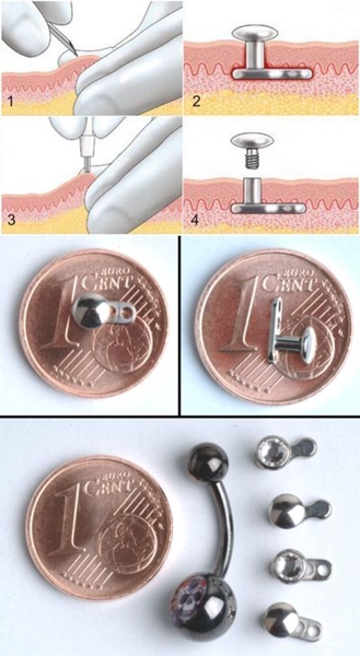 Microdermal piercing: hur microdermabras görs (foto)