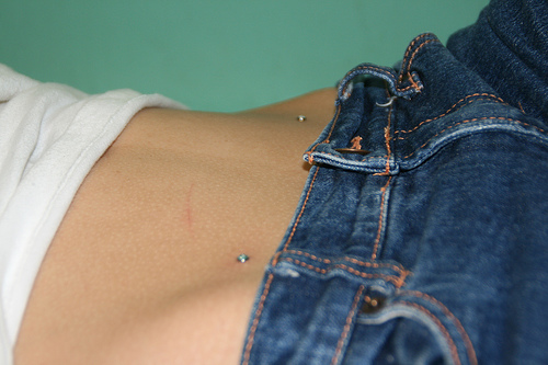 Microdermal piercing: hur microdermabras görs (foto)