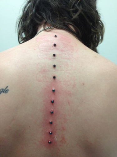 Microdermal piercing: hur microdermabras görs (foto)