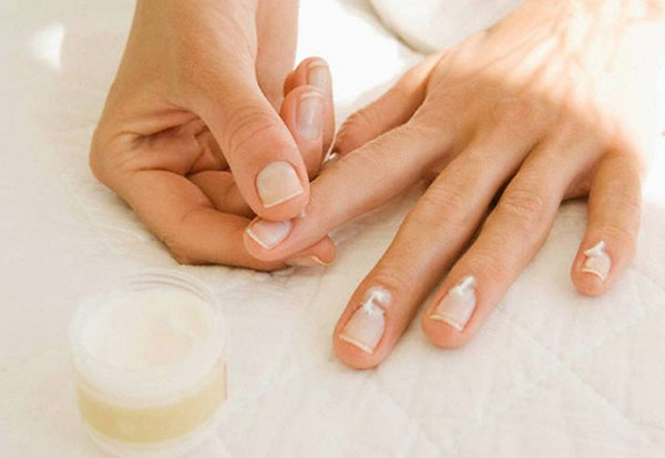 Fem frekventa nagelproblem: orsaker och lösningar