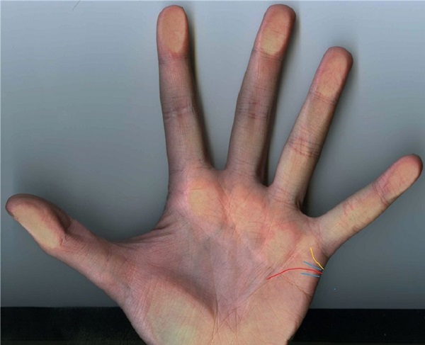 Äktenskapslinje till hands