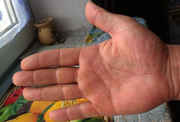 Äktenskapslinje till hands