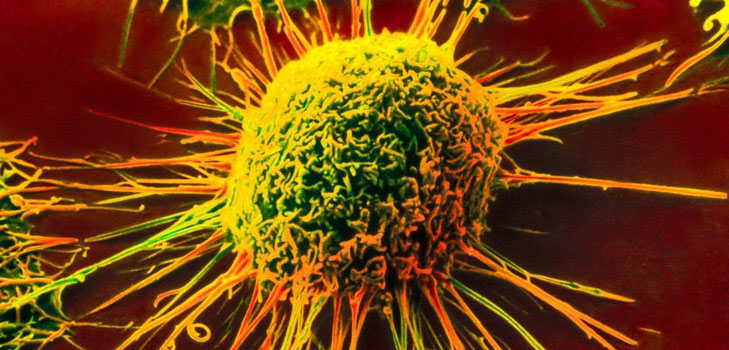 Vilken typ av cancer är den farligaste?