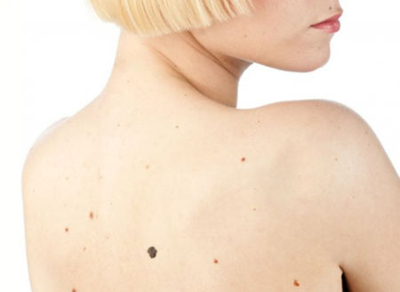 Vilken typ av cancer är den farligaste?