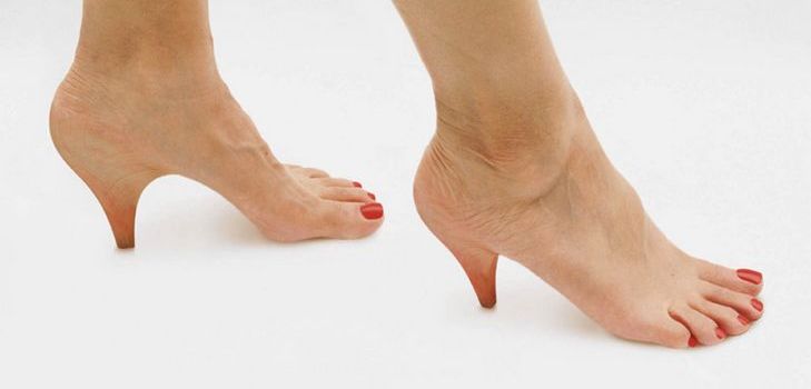 Heel spurs: behandling med folkmekanismer