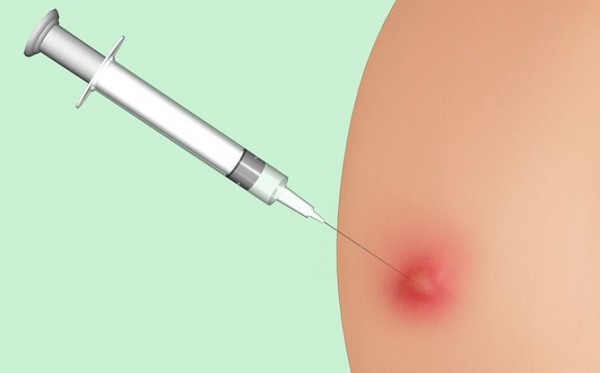 Konen efter injektionen i skinkan löser inte: behandling av komprimering och blåmärken efter injektion i skinkan