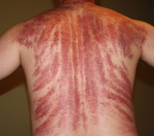 Gouache massage teknik